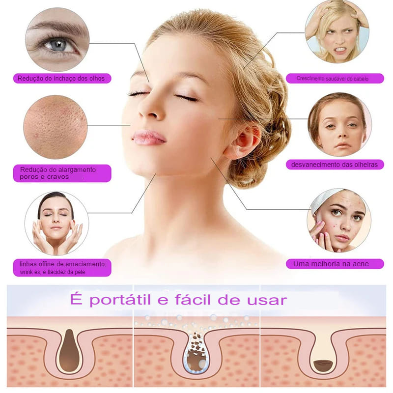 Aparelho de Alta Frequência para Limpeza de Pele - Derma Skin